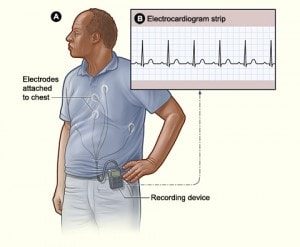 24-hour ambulatory blood pressure monitor (ABPM)